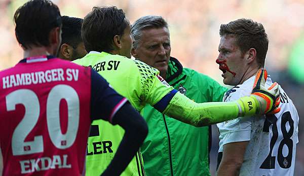 Andre Hahn erlitt nach einem Zusammenstoß mit Rene Adler eine blutige Nase