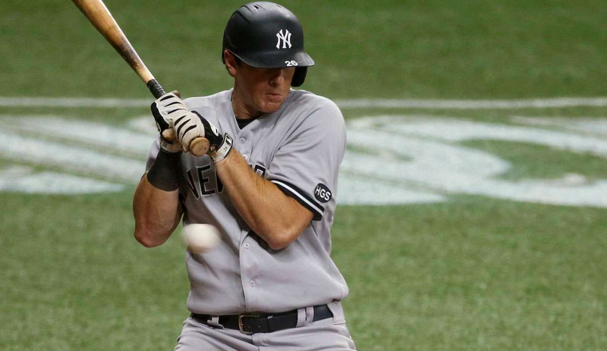 DJ LeMahieu hat sich gegen die Boston Red Sox am Daumen verletzt.