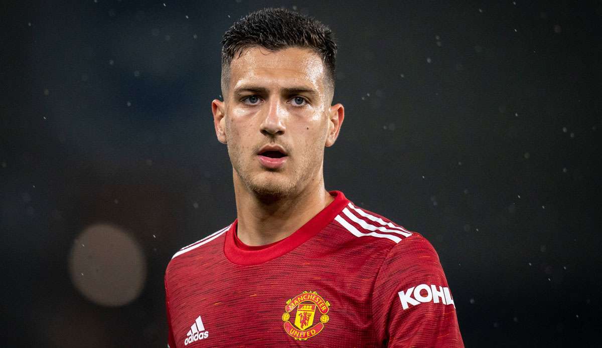 Diogo Dalot kam 2018 vom FC Porto zu den Red Devils.