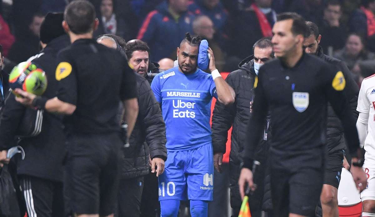 "Sie forderten den Referee auf, nach Payet zu schauen. Unser Arzt sagte zu mir, dass es bei ihm aber mehr Angst als Schmerz sei", sagte Aulas. Bedenklich: das war die bereits dritte Spielunterbrechung in dieser noch jungen Ligue-1-Saison.