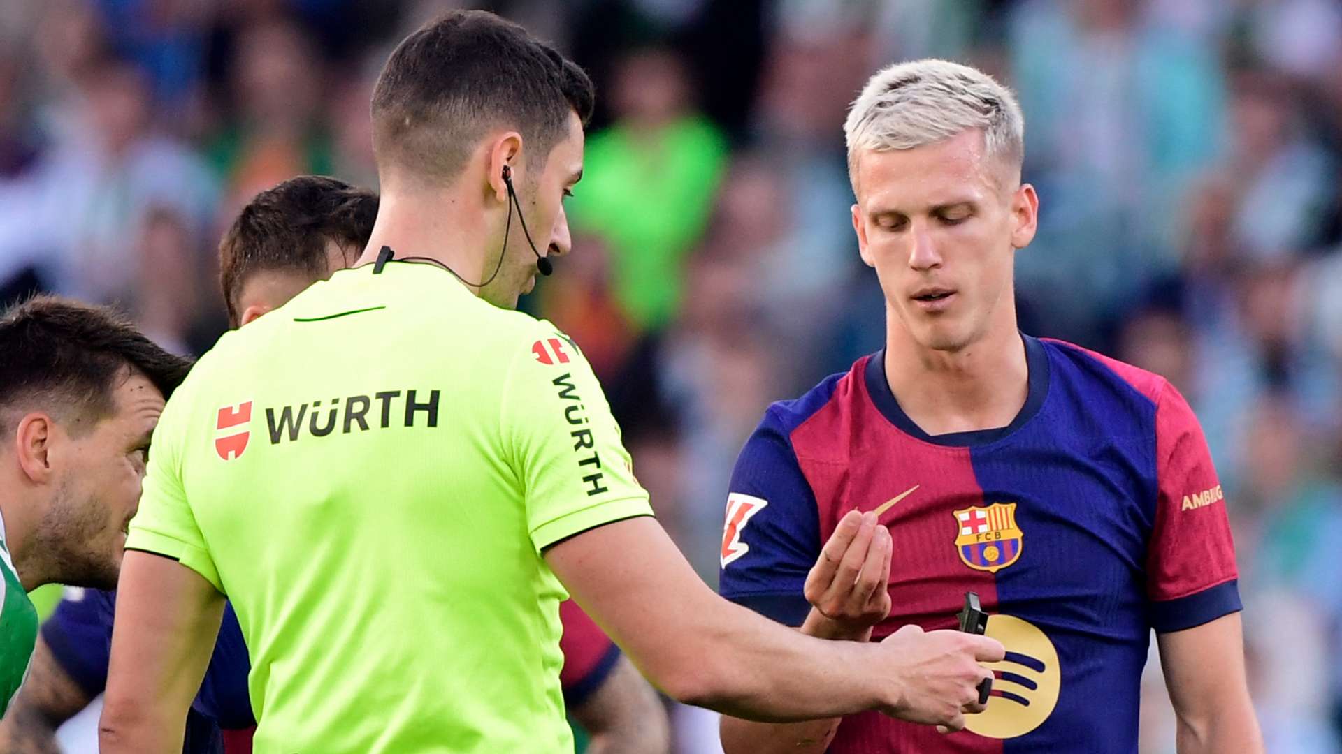 Dani Olmo tooth Barcelona Real Betis 2024-25