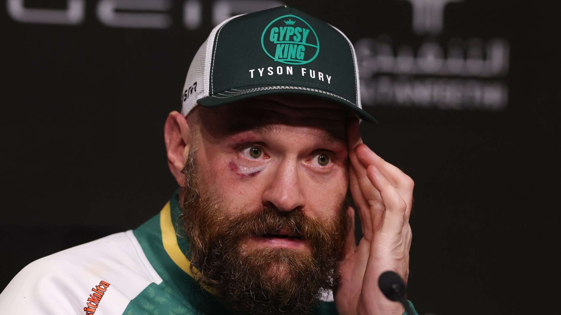 Tyson Fury 2024